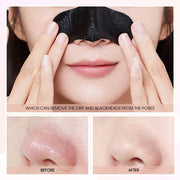 Charcoal Nose Strip